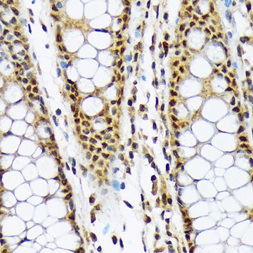 Anti-MAD2L1BP Antibody, clone 7W8H1, Rabbit Monoclonal