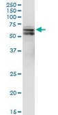 Monoclonal Anti-PDPK1, (C-terminal) antibody produced in mouse clone 2E2, purified immunoglobulin, buffered aqueous solution