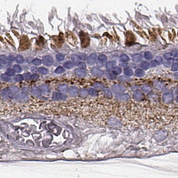 Anti-RDH13 antibody produced in rabbit Prestige Antibodies&#174; Powered by Atlas Antibodies, affinity isolated antibody, buffered aqueous glycerol solution