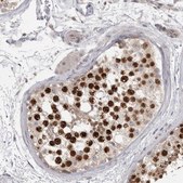 Anti-TOP2A antibody produced in rabbit Prestige Antibodies&#174; Powered by Atlas Antibodies, affinity isolated antibody, buffered aqueous glycerol solution, Ab2