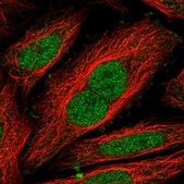 Anti-NIPBL antibody produced in rabbit Prestige Antibodies&#174; Powered by Atlas Antibodies, affinity isolated antibody, buffered aqueous glycerol solution