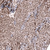 Anti-FOXL2 antibody produced in mouse Prestige Antibodies&#174; Powered by Atlas Antibodies, clone CL12762, purified by using Protein A, buffered aqueous glycerol solution
