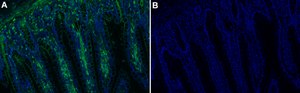 Anti-&#945;-Actinin-1 Antibody, clone 2C17 ZooMAb&#174; Rabbit Monoclonal recombinant, expressed in HEK 293 cells