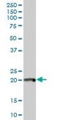 Anti-POLE3 antibody produced in mouse purified immunoglobulin, buffered aqueous solution