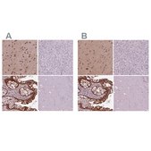Anti-SRI antibody produced in rabbit Prestige Antibodies&#174; Powered by Atlas Antibodies, affinity isolated antibody