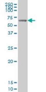 ANTI-GRK6 antibody produced in mouse clone 8B7, purified immunoglobulin, buffered aqueous solution