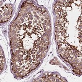 Anti-ATG16L1 antibody produced in rabbit Prestige Antibodies&#174; Powered by Atlas Antibodies, affinity isolated antibody, buffered aqueous glycerol solution