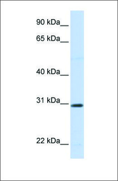 Anti-STC1 antibody produced in rabbit affinity isolated antibody