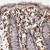Anti-WAS antibody produced in rabbit Prestige Antibodies&#174; Powered by Atlas Antibodies, affinity isolated antibody, buffered aqueous glycerol solution