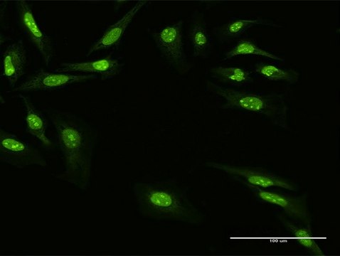 Anti-ZNF668 antibody produced in mouse purified immunoglobulin, buffered aqueous solution