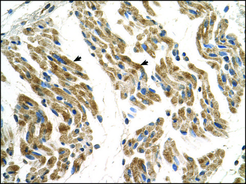 Anti-SLC35F2 antibody produced in rabbit IgG fraction of antiserum