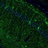 Anti-MAP2 antibody produced in rabbit Prestige Antibodies&#174; Powered by Atlas Antibodies, affinity isolated antibody, buffered aqueous glycerol solution