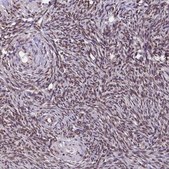 Anti-TRIM22 antibody produced in rabbit Ab2, Prestige Antibodies&#174; Powered by Atlas Antibodies, affinity isolated antibody, buffered aqueous glycerol solution