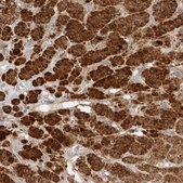 Anti-RAB32 antibody produced in rabbit Prestige Antibodies&#174; Powered by Atlas Antibodies, affinity isolated antibody, buffered aqueous glycerol solution
