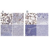 Anti-FCN1 antibody produced in rabbit Ab2, Prestige Antibodies&#174; Powered by Atlas Antibodies, affinity isolated antibody, buffered aqueous glycerol solution