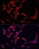 Anti- YAP1 antibody produced in rabbit