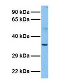 Anti-KLF6 affinity isolated antibody