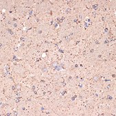 Anti-GABA transaminase (ABAT) Antibody, clone 10V1K9, Rabbit Monoclonal