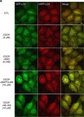 Anti-LC3 antibody produced in rabbit ~1&#160;mg/mL, affinity isolated antibody, buffered aqueous solution