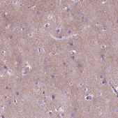 Anti-GABRB2 antibody produced in rabbit Prestige Antibodies&#174; Powered by Atlas Antibodies, affinity isolated antibody, buffered aqueous glycerol solution