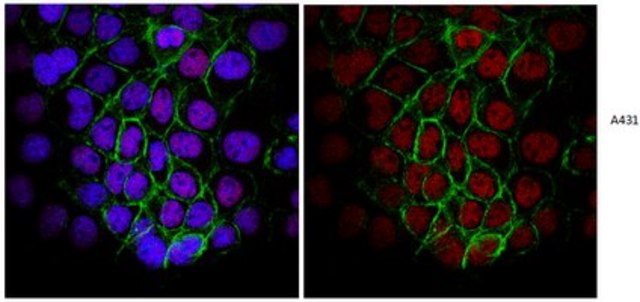 Anti-Replication Protein A Antibody, clone RPA34-19 clone RPA34-19, from mouse