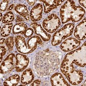 Anti-SDHB antibody produced in rabbit Prestige Antibodies&#174; Powered by Atlas Antibodies, affinity isolated antibody, buffered aqueous glycerol solution