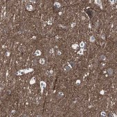Anti-SSTR2 antibody produced in rabbit Prestige Antibodies&#174; Powered by Atlas Antibodies, affinity isolated antibody, buffered aqueous glycerol solution