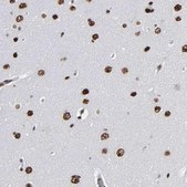 Anti-ATRX antibody produced in rabbit Prestige Antibodies&#174; Powered by Atlas Antibodies, affinity isolated antibody, buffered aqueous glycerol solution