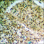 Anti-phospho-PTEN (pSer385) antibody produced in rabbit affinity isolated antibody