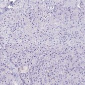 Anti-KCNQ2 antibody produced in rabbit Prestige Antibodies&#174; Powered by Atlas Antibodies, affinity isolated antibody, buffered aqueous glycerol solution