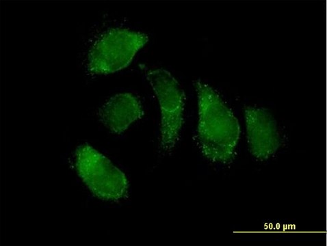 Anti-EHHADH antibody produced in mouse IgG fraction of antiserum, buffered aqueous solution