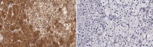 Anti-MerTK Antibody, clone 2E14 ZooMAb&#174; Rabbit Monoclonal recombinant, expressed in HEK 293 cells