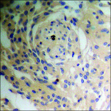 Anti-phospho-Tuberin/TSC2 (pSer939) antibody produced in rabbit affinity isolated antibody