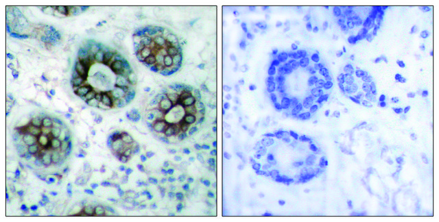 Anti-GAP43 antibody produced in rabbit affinity isolated antibody