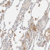 Anti-C8B antibody produced in rabbit Prestige Antibodies&#174; Powered by Atlas Antibodies, affinity isolated antibody, buffered aqueous glycerol solution