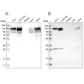 Anti-CCAR2 antibody produced in rabbit Prestige Antibodies&#174; Powered by Atlas Antibodies, affinity isolated antibody, buffered aqueous glycerol solution, Ab1