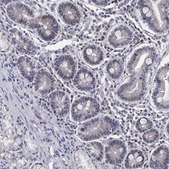 Anti-CD177 antibody produced in rabbit Prestige Antibodies&#174; Powered by Atlas Antibodies, affinity isolated antibody, buffered aqueous glycerol solution