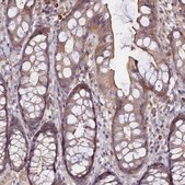 Anti-CLCF1 antibody produced in rabbit Prestige Antibodies&#174; Powered by Atlas Antibodies, affinity isolated antibody, buffered aqueous glycerol solution