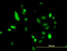 Monoclonal Anti-UBE2C antibody produced in mouse clone 9D3, purified immunoglobulin, buffered aqueous solution