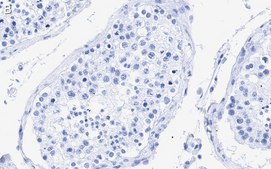 Anti-Centrin Antibody, clone 20H5 ZooMAb&#174; Mouse Monoclonal recombinant, expressed in HEK 293 cells