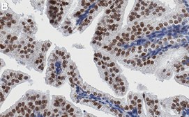 Anti-CHD-8 Antibody, clone 1H9 ZooMAb&#174; Rabbit Monoclonal recombinant, expressed in HEK 293 cells
