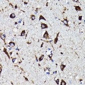 Anti-Cathepsin D Antibody, clone 2B3E8, Rabbit Monoclonal