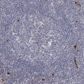 Anti-SLC9A3R2 antibody produced in rabbit Prestige Antibodies&#174; Powered by Atlas Antibodies, affinity isolated antibody, buffered aqueous glycerol solution