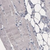 Monoclonal Anti-SLCO1B3 antibody produced in mouse Prestige Antibodies&#174; Powered by Atlas Antibodies, clone CL3771, purified immunoglobulin, buffered aqueous glycerol solution