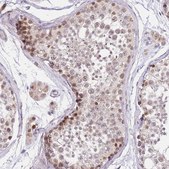 Anti-PUS10 antibody produced in rabbit Prestige Antibodies&#174; Powered by Atlas Antibodies, affinity isolated antibody, buffered aqueous glycerol solution