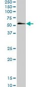 Monoclonal Anti-SMAD5 antibody produced in mouse clone 2D7, purified immunoglobulin, buffered aqueous solution