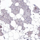 Anti-ARSB antibody produced in rabbit Prestige Antibodies&#174; Powered by Atlas Antibodies, affinity isolated antibody, buffered aqueous glycerol solution