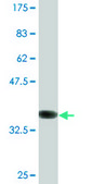 Monoclonal Anti-DIRAS3 antibody produced in mouse clone 1G4, ascites fluid