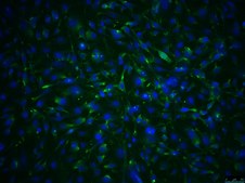 OSUMMER.10 Mouse NRAS-Mutant Melanoma Cell Line