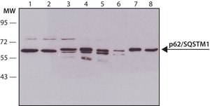Anti-p62/SQSTM1 antibody produced in rabbit ~1&#160;mg/mL, affinity isolated antibody, buffered aqueous solution